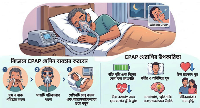 ঘুমের মধ্যে শ্বাস বন্ধ হয়ে গেলে কি করণীয়
